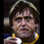 migranas-y-amputaciones