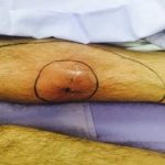 alejandro-fernandez-tiene-gangrena