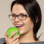 20-cosas-que-solo-sabran-quienes-han-usado-brackets