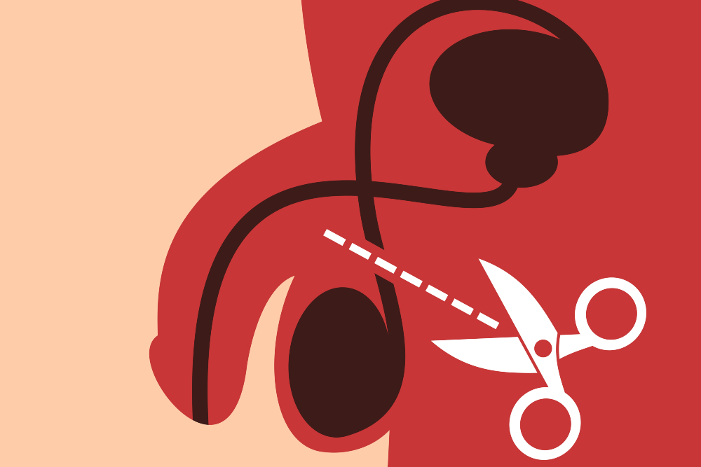 Vasectomía gratuita en CDMX