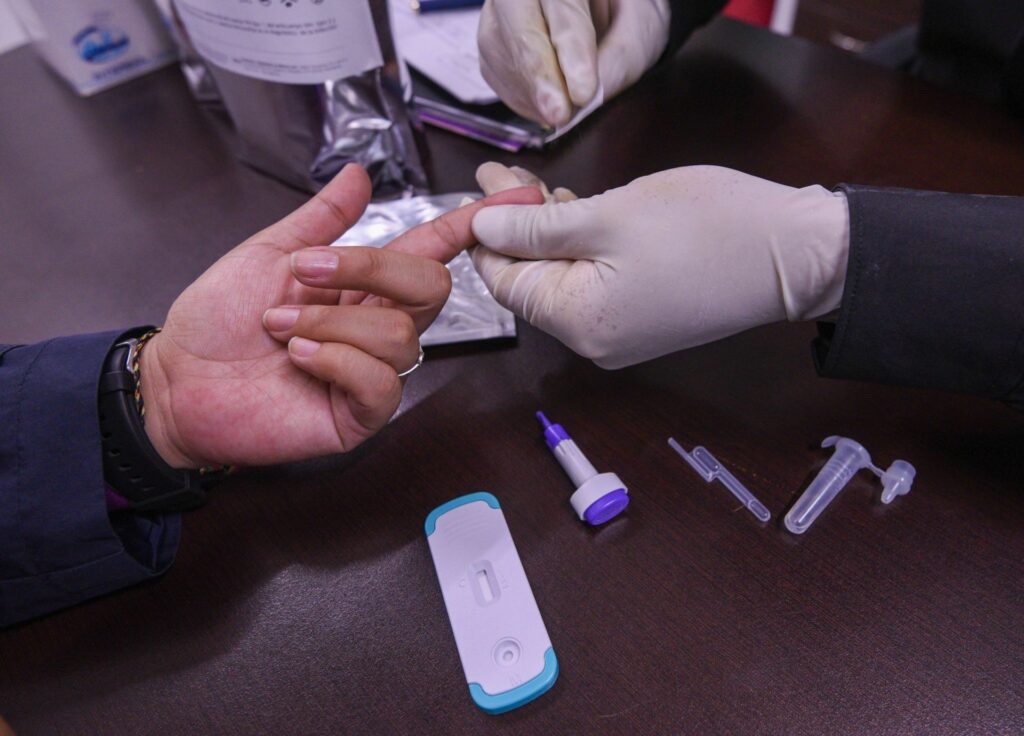 Prueba de VIH/Sida.