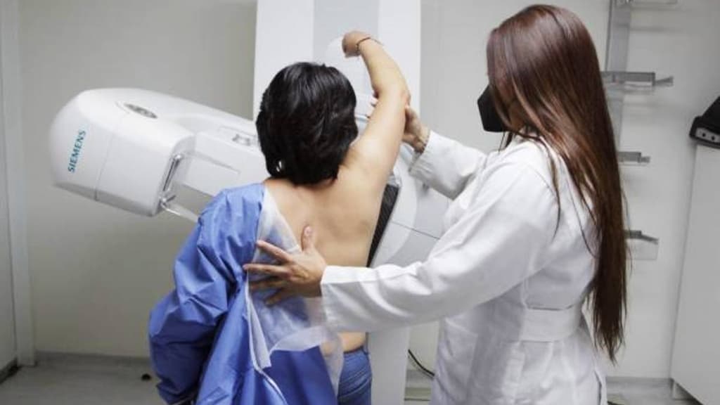 mastografias-gratis-en-cdmx