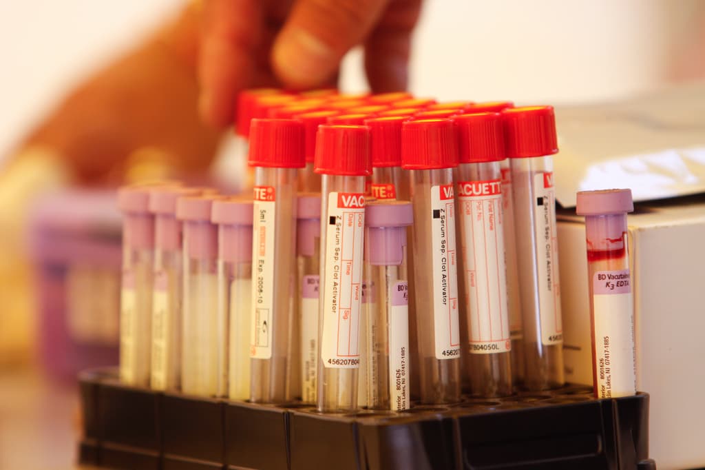 Pruebas gratis para detectar el VIH en el Inspira Fest 2019