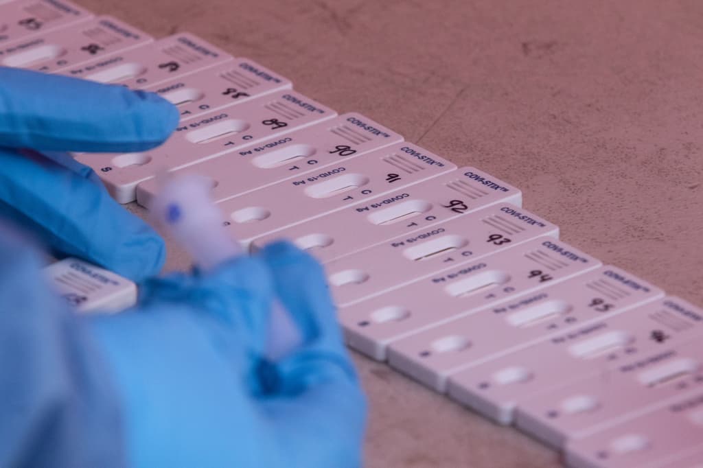 pruebas en sangre para detectar covid